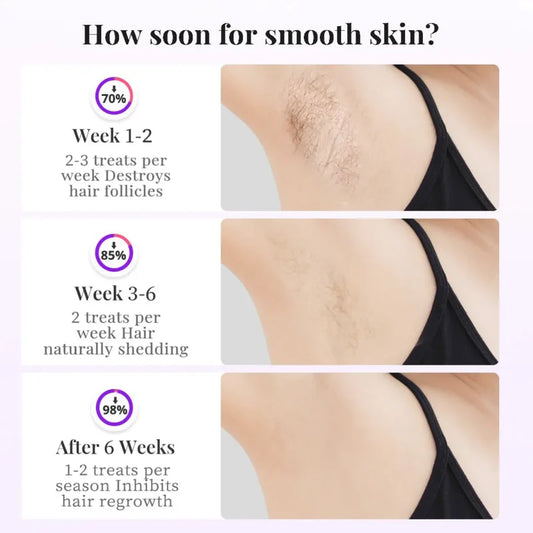 HIKYSKIN Sapphire Ice-Pro IPL Hair Removal